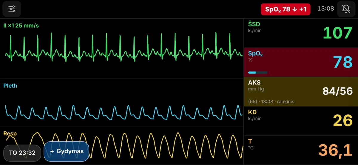 Monitoriaus vaizdas: EKG, pletizmograma, kvėpavimas, ŠSD 107, SpO₂ 78, AKS 84/56